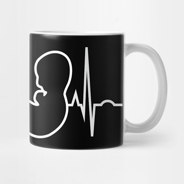 Pregnant Mammogram Heartbeat for Baby by GuiltlessGoods